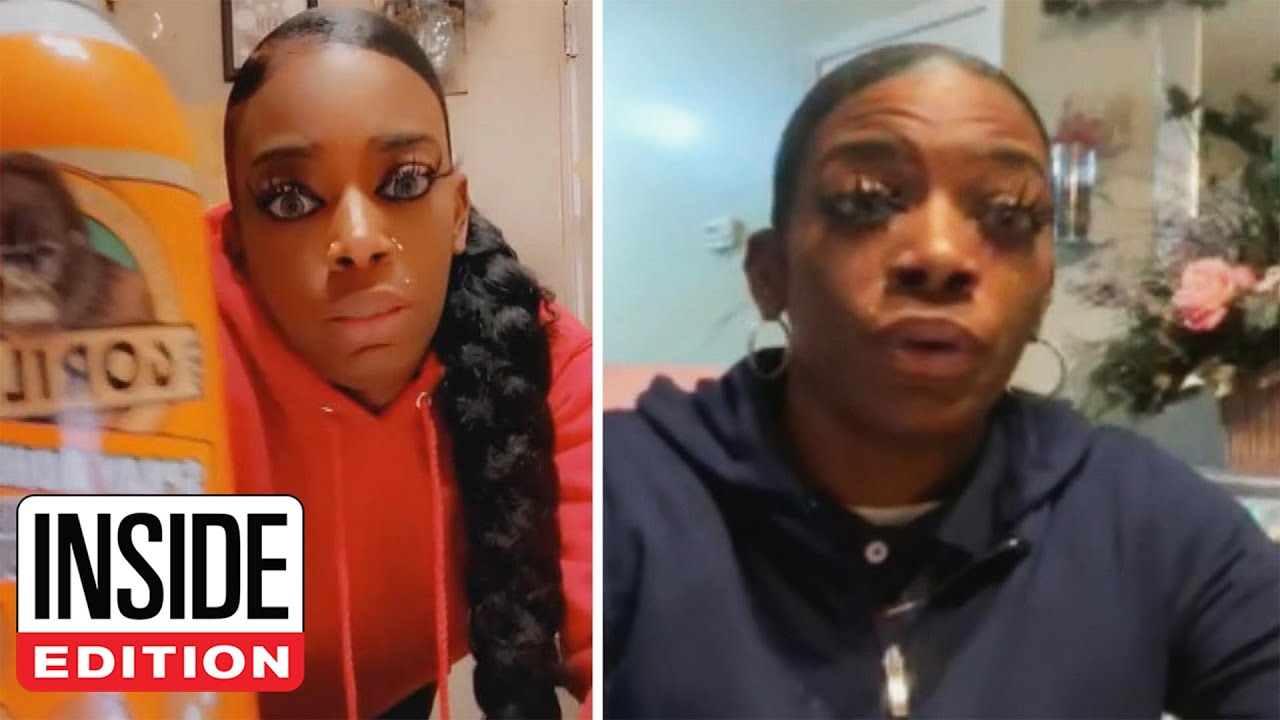 TikToker Who Used Gorilla Glue in Hair Says ER Couldn’t Help