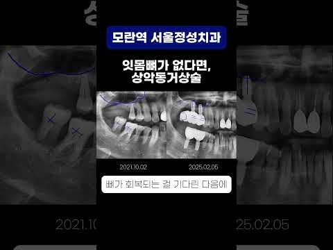 땡큐성형외과 Clips