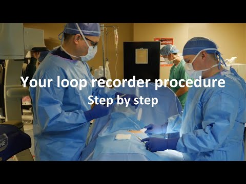 image-How long does it take to implant a loop recorder?