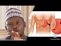 MAGANIN CIWON ULCER DR ABDULWAHAB ABUBAKAR GONI BAUCHI HAFIZAHULLAH