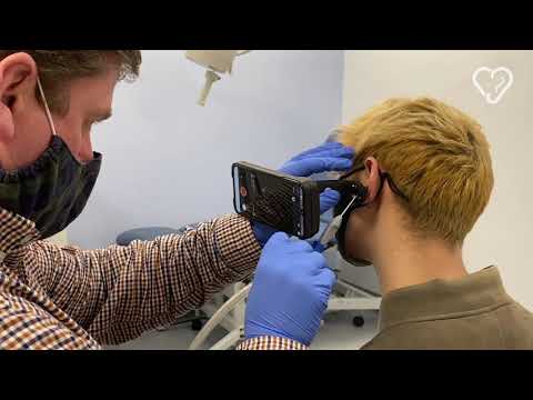 Ear wax plug removal using microsuction with the Tympa system