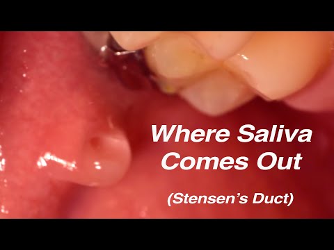 Stensen's Duct Salivation Superzoom - Where Saliva Comes From