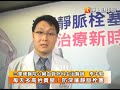 每天多高抬貴腿！防深層靜脈栓塞