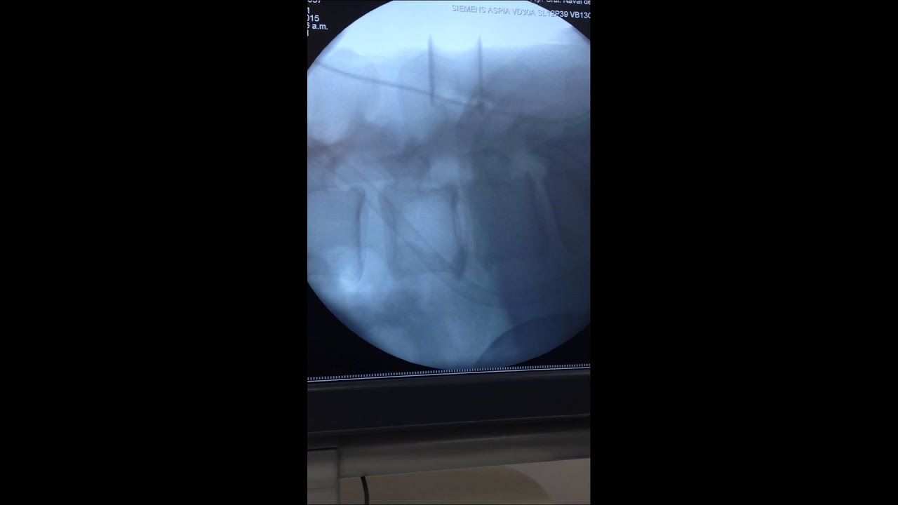 Enrique De Obieta Cruz-52