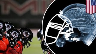 NFL brain damage: League acknowledges link between CTE and football-related head injuries