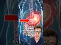 STOMACH CANCER 9 Potential Signs And Symptoms Shorts Health