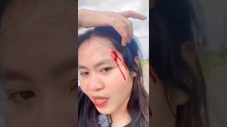 Download lagu Sakit bangettt🥹😭 mp3