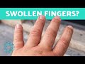 My FINGERS Are SWELLING for No Reason 🖐️ (Finger Inflammation Causes)