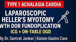 Type 1 Achalasia Cardia | Laparoscopic Heller’s Myotomy with Dor Fundoplication (ICG + On-table OGD)