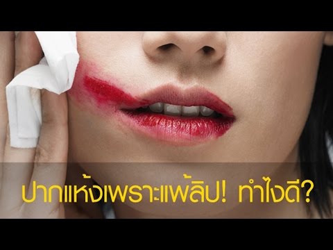 ครีมที่มีศักยภาพสำหรับกลาก ครีมเตียรอยด์โรคผิวหนังภูมิแพ้