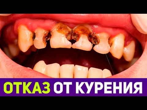 Ношение бандажа коленного сустава Какая кость входит в состав грудного отдела
