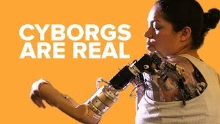 Real Life Cyborgs You Didn't Know Existed