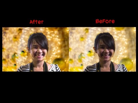 เต้านมเทียม Allergan ฉันเต็ม แต่ฉันมีหน้าอกเล็ก