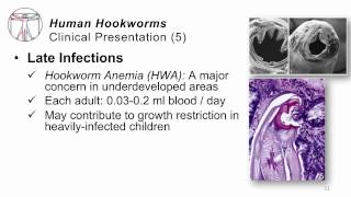 Helminths Hookworms