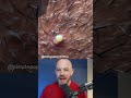 Juicy Ingrown Hair Removal Dermreacts Doctorreacts Ingrownhair