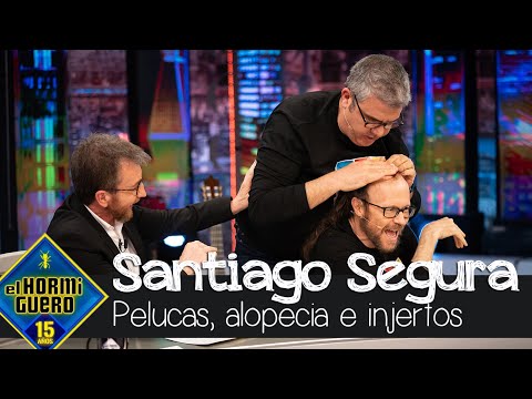 Santiago Segura habla de pelucas, alopecia e injertos ¿Se ha planteado ir a Turquía? - El Hormiguero