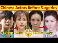 Chinese Actors Before And After Plastic Surgeries Incredible Changes Chinese Drama