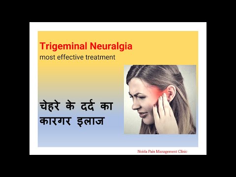 Trigeminal Neuralgia Most Effective Treatment 