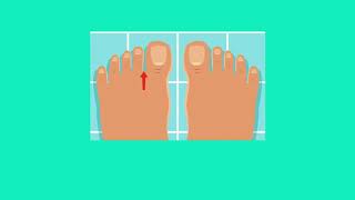 Download lagu Cara Mencuci Kaki Dengan Benar mp3