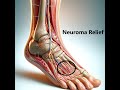 How to solve a Morton's Neuroma