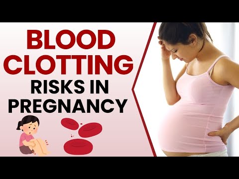 Unusual Blood Clotting During Pregnancy: Can It Cause A Miscarriage?