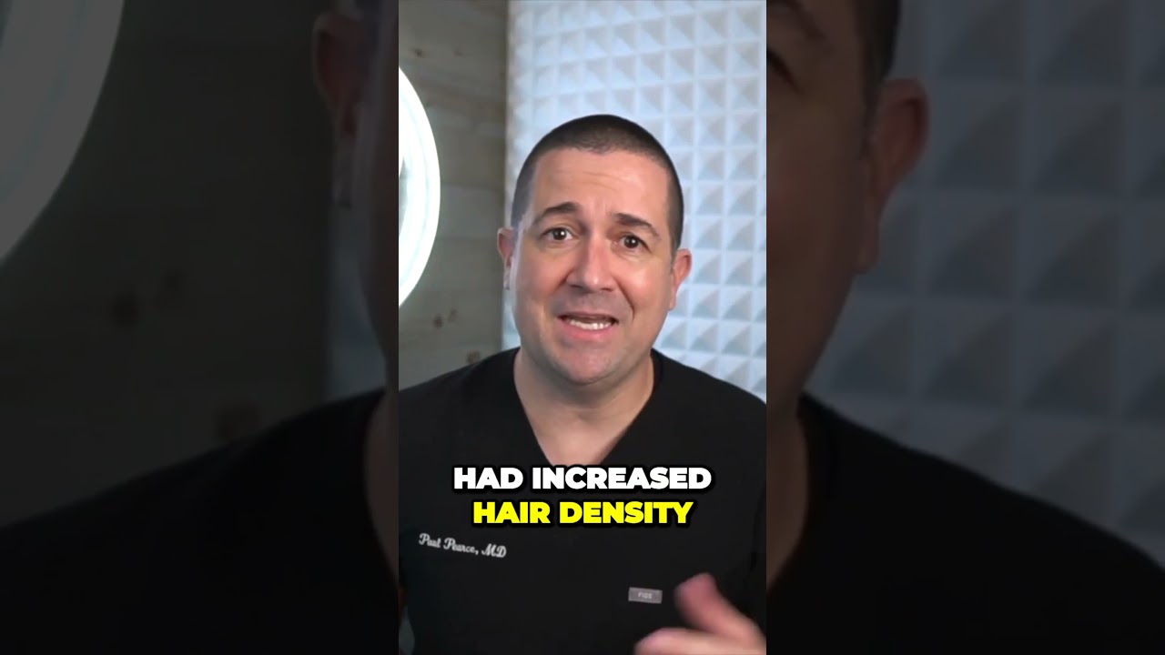 PRP for Hair Loss?