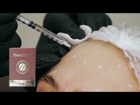 Botox Injection