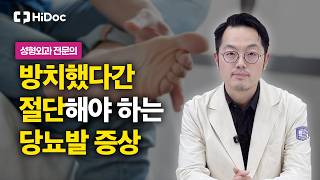 통증 없어도 방치하면 위험한 당뇨발, 당장 병원 가야하는 증상은? | 성형외과 전대원 교수