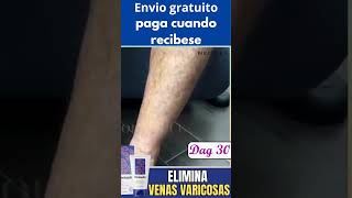 Veniselle el mejor producto para ayudar con las varices #varices #piernas #piernasperfectas