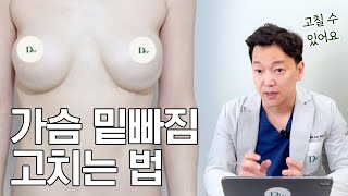 가슴 보형물이 밑으로 빠진다고? #디테성형외과 #이준욱원