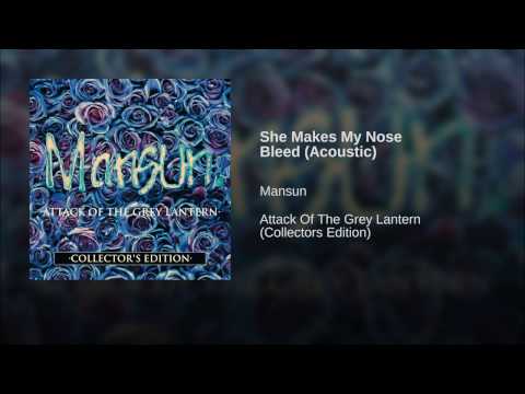 Video thumbnail for She Makes My Nose Bleed (Acoustic)