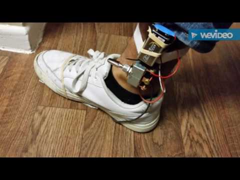 Shocking things with a Negative Ion Generator