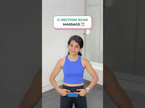 7 Weeks C-Section SCAR MASSAGE ☺️