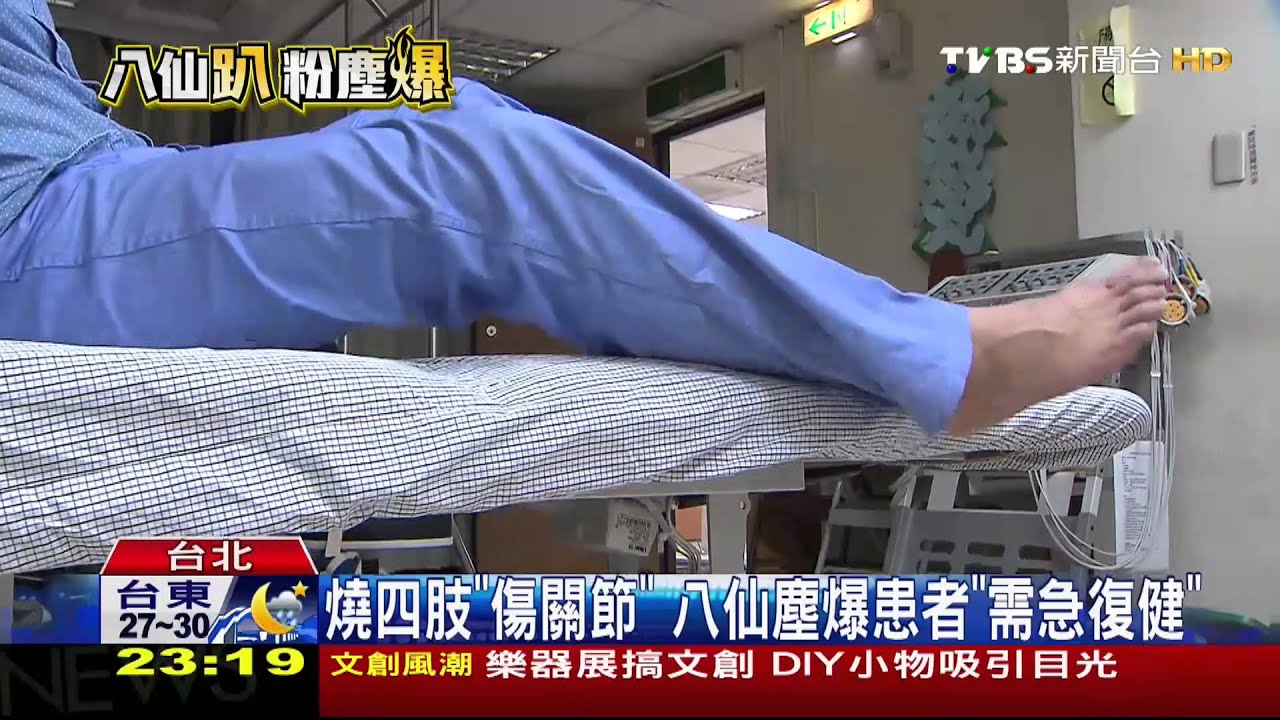 燒燙傷復健慢不得！　應「擺位」防關節攣縮