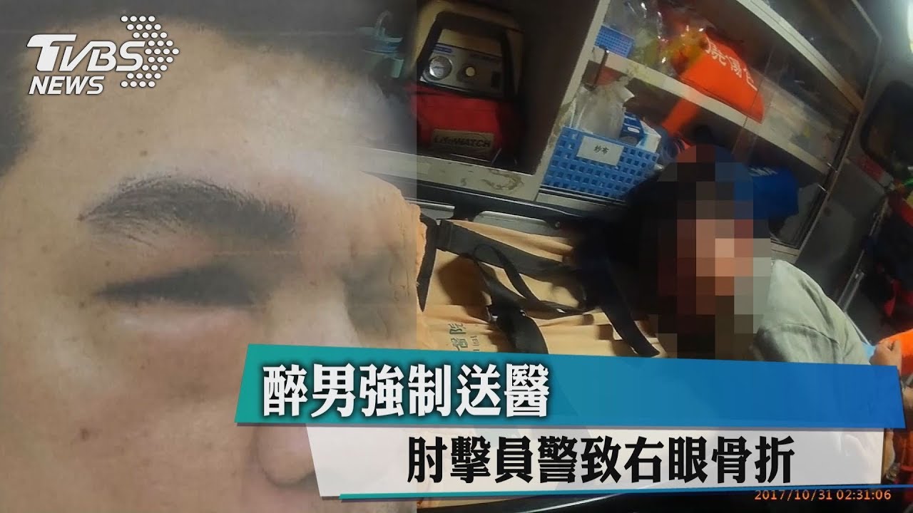 醉男強制送醫 肘擊員警致右眼軟骨骨折