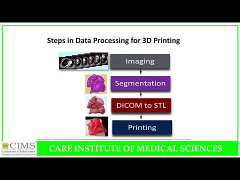 Transcatheter Aortic Valve Implantation (TAVI) / (TAVR) after 3D - Printed Model Demonstration.