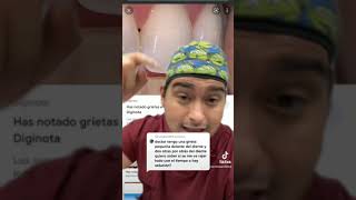 ¿QUE SON ESAS FISURAS O LÍNEAS VERTICALES EN TUS DIENTES 😵 ¡TE EXPLICO! 🤤