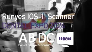 Runyes IOS-1 интраоральный сканер (DENTAL EXPO 2024)