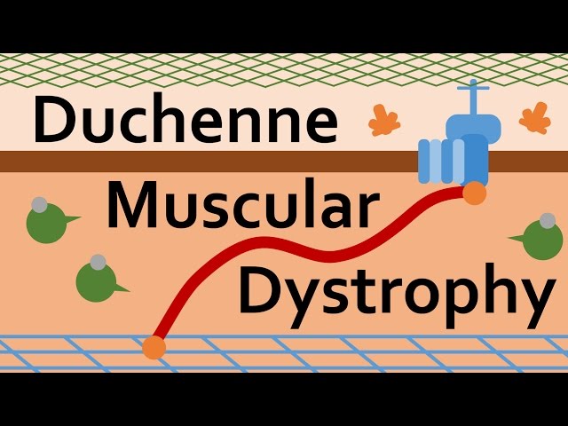Vidéo Prononciation de dystrophy en Anglais Vidéo Prononciation de dystrophy en Anglais
