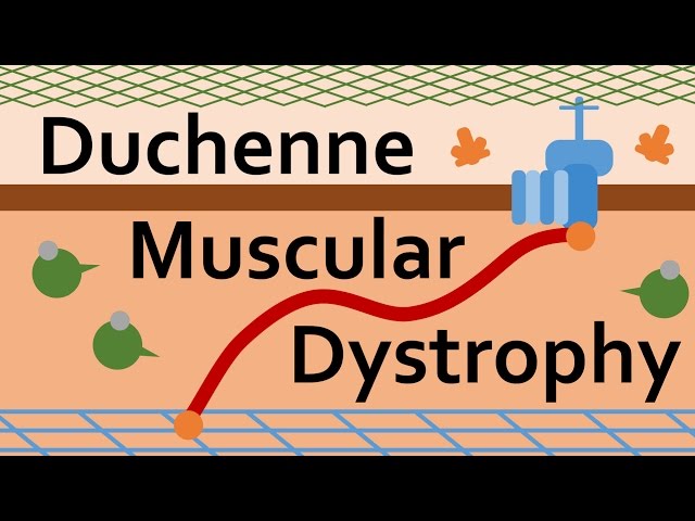 英語のdystrophyのビデオ発音