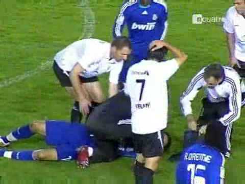 de la red fainted suddenly