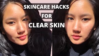 Life-changing SKINCARE HACKS for CLEAR SKIN ! Level Up your SKINCARE ROUTINE during Quarantine