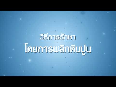การรักษารีสอร์ท Krasnodar ของโรคสะเก็ดเงิน โรคสะเก็ดเงินครีม redetsil