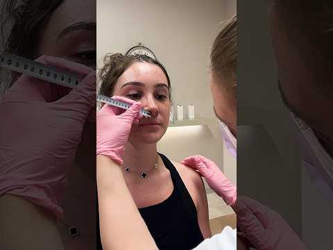 Maria Teresa Kumar Lips Surgery