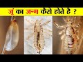 जूँ का जीवन चक्र सिर में जूँ कैसे आती ह�