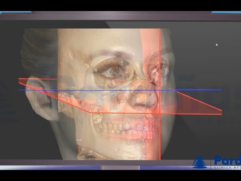 3D 두개 진단과 치과교정학 ©