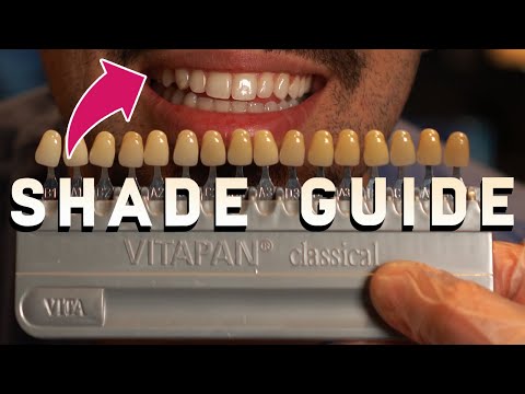 Best Shade Taking Hints & Tips! | Easy Workflow