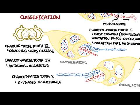 Charcot - Marie-Tooth-Krankheit