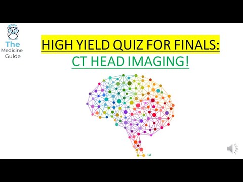 HIGH YIELD QUIZ FOR FINALS: CT HEAD IMAGING!