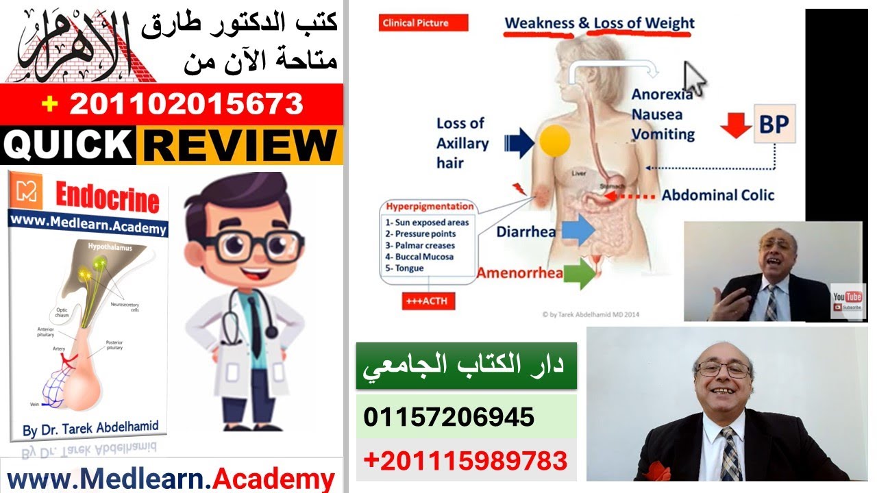 Adrenal Insufficiency (Quick Review) #cme #internal_medicine #usmle #medicalstudent #محاضرات_باطنة
